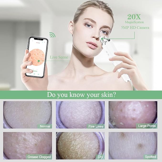 جهاز إزالة الرؤوس السوداء بالشفط